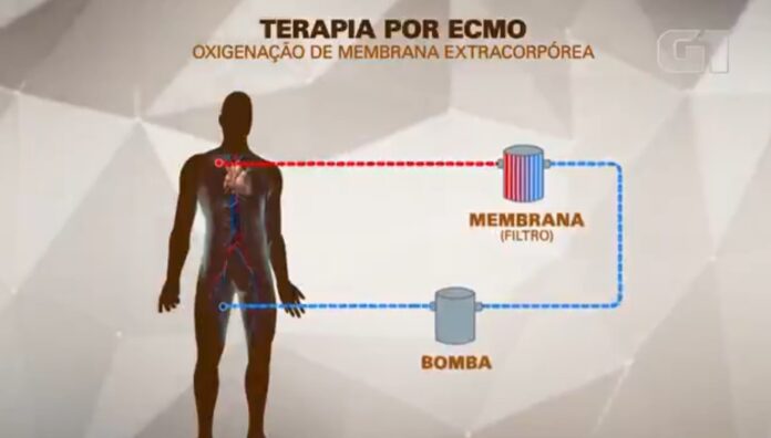 mc-marcinho-usa-terapia-conhecida-como-ecmo,-especie-de-pulmao-artificial;-entenda-como-funciona mc-marcinho-usa-terapia-conhecida-como-ecmo,-especie-de-pulmao-artificial;-entenda-como-funciona