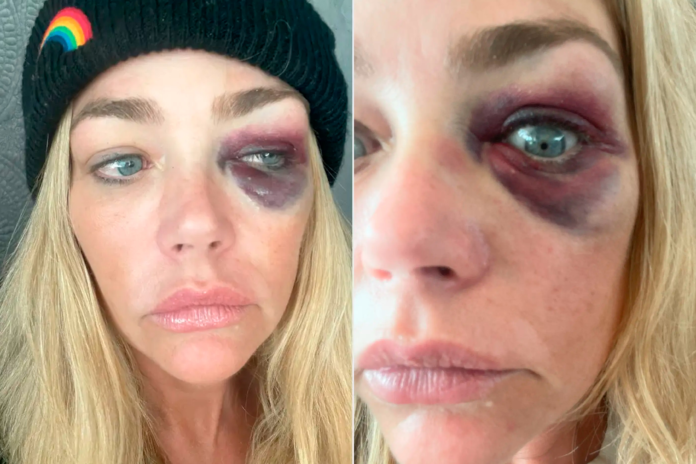 denise-richards-acusa-ex-marido-de-agressao denise-richards-acusa-ex-marido-de-agressao