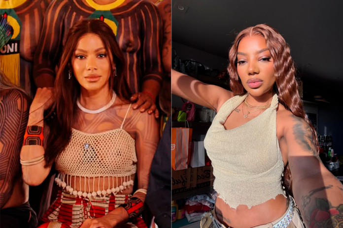 novo-rosto-de-anitta-revive-debate-sobre-padrao-estetico-entre-celebridades novo-rosto-de-anitta-revive-debate-sobre-padrao-estetico-entre-celebridades