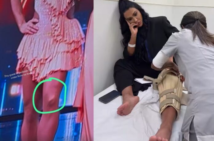 gracyanne-barbosa-fala-sobre-pausa-apos-lesao-no-joelho:-‘hoje-comeco-a-danca-da-recuperacao’